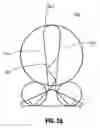 Fig. 04 - Antipersonnel barrier system