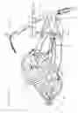 Fig. 02 - Hand powered bicycle