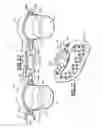 Fig. 14 - Stroller