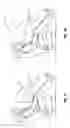 Fig. 02 - Airbag tether release