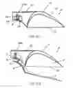 Fig. 05 - Detachable hinging mechanism for access panel