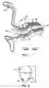 Fig. 02 - Perforated cap for a hearing aid