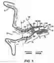 Fig. 03 - Perforated cap for a hearing aid