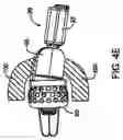 Fig. 07 - Perforated cap for a hearing aid