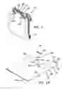Fig. 02 - Twin support aperture side tear bag pack