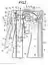 Fig. 03 - Cleaning device for a fixing unit