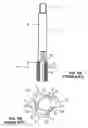 Fig. 02 - Thread cutting tap and a method of its manufacture