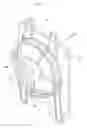 Fig. 09 - Fan and shroud assembly