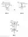 Fig. 02 - Helically actuated positive-displacement pump and method