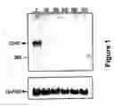 Fig. 02 - Methods for diagnosing and treating tumors and suppressing cd promoters