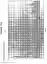 Fig. 21 - Compositions and methods for the treatment of tumor of hematopoietic origin