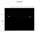 Fig. 23 - Cytotoxicity mediation of cells evidencing surface expression of CD44