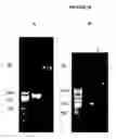 Fig. 28 - Cytotoxicity mediation of cells evidencing surface expression of CD44