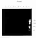 Fig. 29 - Cytotoxicity mediation of cells evidencing surface expression of CD44