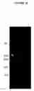 Fig. 31 - Cytotoxicity mediation of cells evidencing surface expression of CD44