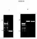 Fig. 32 - Cytotoxicity mediation of cells evidencing surface expression of CD44