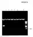 Fig. 33 - Cytotoxicity mediation of cells evidencing surface expression of CD44