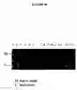 Fig. 44 - Cytotoxicity mediation of cells evidencing surface expression of CD44