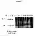 Fig. 45 - Cytotoxicity mediation of cells evidencing surface expression of CD44