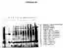 Fig. 49 - Cytotoxicity mediation of cells evidencing surface expression of CD44