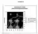 Fig. 53 - Cytotoxicity mediation of cells evidencing surface expression of CD44