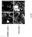Fig. 08 - Methods of inhibiting alphavBeta3-mediated angiogenesis and tumor development