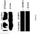 Fig. 17 - Methods of inhibiting alphavBeta3-mediated angiogenesis and tumor development