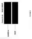 Fig. 09 - Inhibition of angiogenesis and tumor development by IGFBP-4