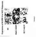 Fig. 10 - Inhibition of angiogenesis and tumor development by IGFBP-4