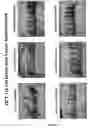 Fig. 15 - Methods and compositions for efficient gene transfer using transcomplementary vectors