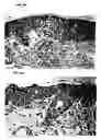 Fig. 10 - Methods for desensitizing a subject to an agent