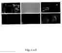 Fig. 07 - Compositions and methods for promoting or inhibiting angiogenesis