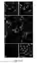 Fig. 11 - Compositions and methods for promoting or inhibiting angiogenesis