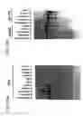 Fig. 22 - Identification of genes