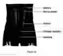 Fig. 03 - Methods for treating a stricture with a botulinum toxin