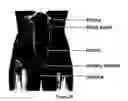 Fig. 04 - Methods for treating a stricture with a botulinum toxin