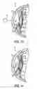 Fig. 08 - Drug delivery system and method