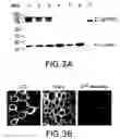 Fig. 07 - Neuronal pain pathway