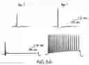 Fig. 09 - Neuronal pain pathway