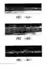 Fig. 06 - Process for face finishing fabrics and fabrics having good strength and aesthetic characteristics