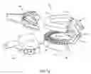 Fig. 02 - Dental modeling and articulating system and method