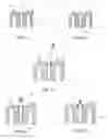 Fig. 09 - Dental modeling and articulating system and method