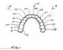 Fig. 02 - Dental appliance