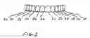 Fig. 03 - Dental appliance