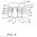 Fig. 05 - Dental appliance