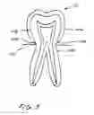 Fig. 06 - Dental appliance