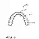 Fig. 07 - Dental appliance