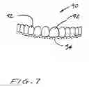 Fig. 08 - Dental appliance
