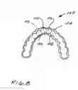 Fig. 09 - Dental appliance