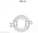 Fig. 04 - Dental implant